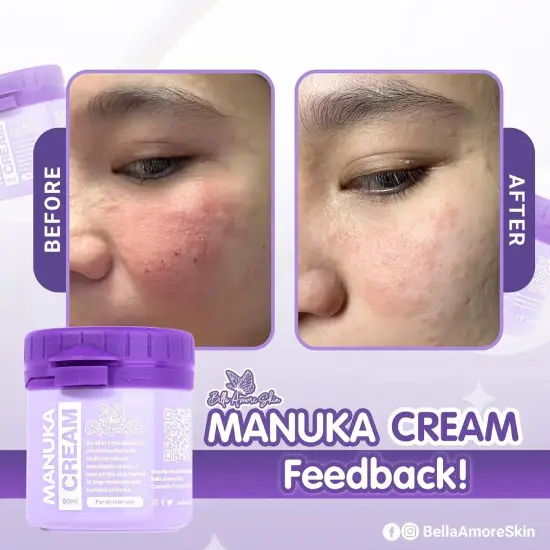 Manuca Cream 3